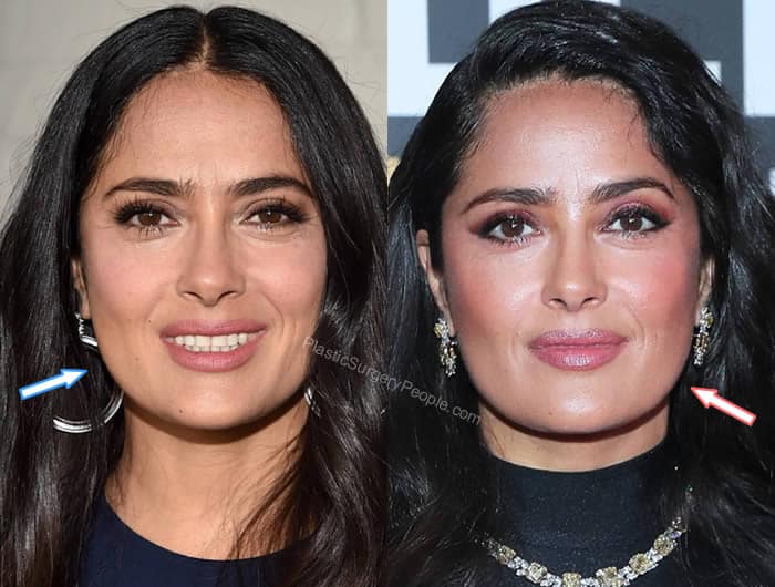 Salma Hayek, Before & After Plastic Surgery Photos Review