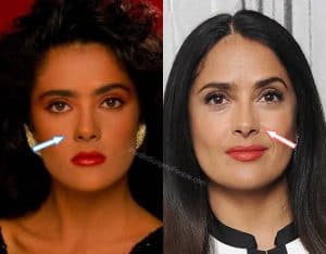 Salma Hayek, Before & After Plastic Surgery Photos Review