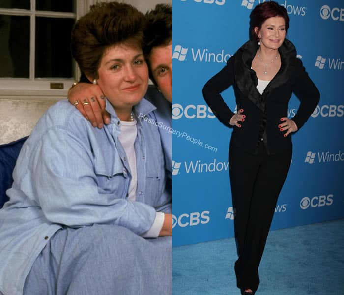 Sharon Osbourne body surgeries before and after