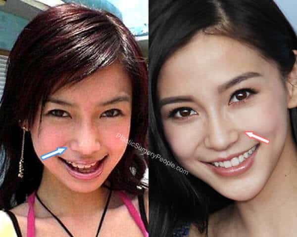 Angelababy Before And After 2019