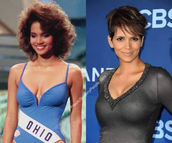 Halle Berry Breast Implants Before and After