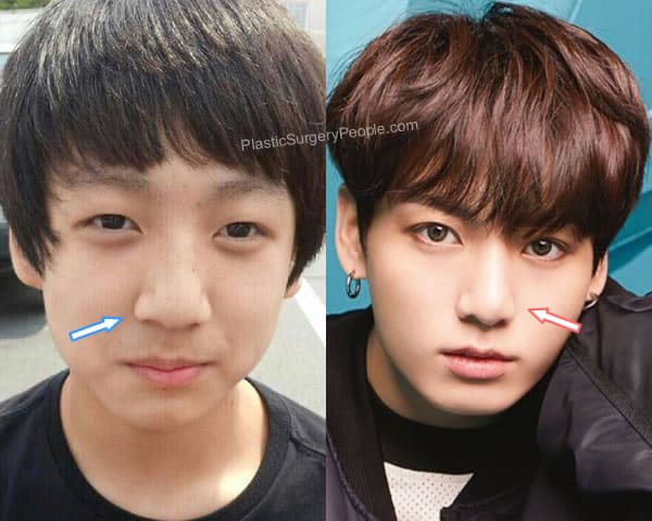Jungkook: BEFORE and AFTER 2022