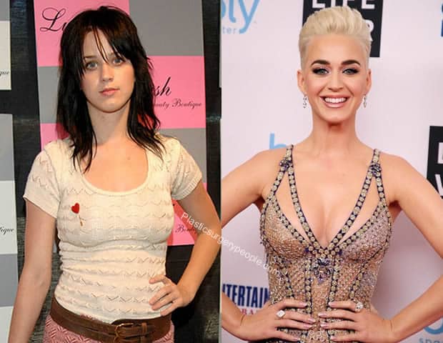 Katy Perry breast implants before and after.