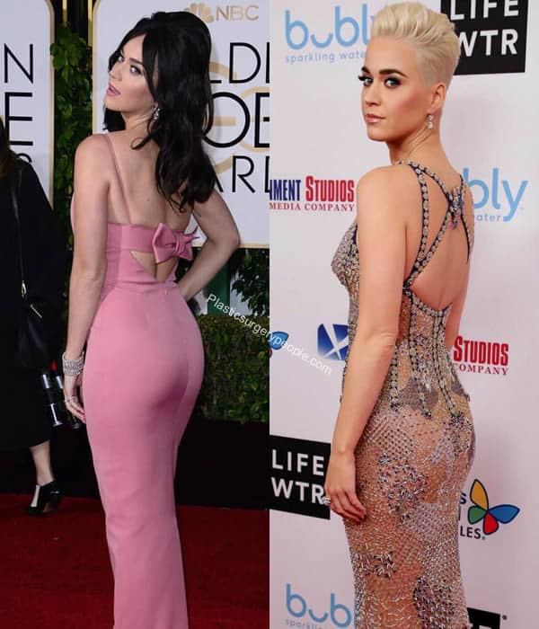 Katy Perry butt lift before and after