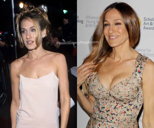 Sarah Jessica Parker boob job before and after