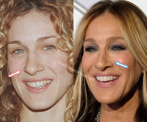 Top 10 of sarah jessica parker plastic surgery. 