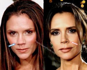 Victoria Beckham, BEFORE and AFTER 2022