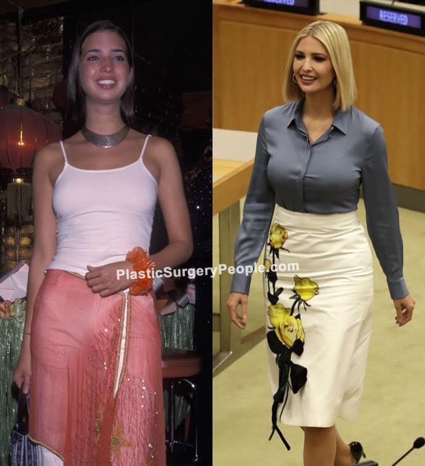 Ivanka Trump BEFORE and AFTER 2022