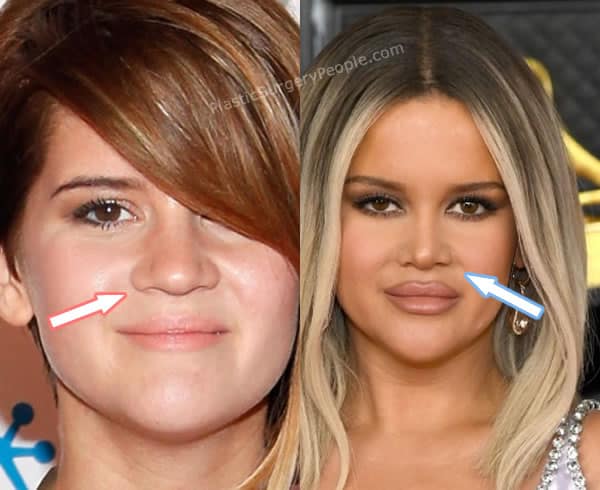 Maren Morris, BEFORE and AFTER 2022
