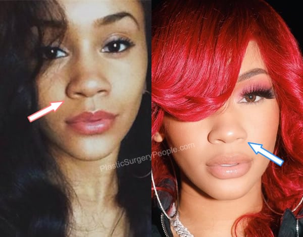 Saweetie nose job before and after photo