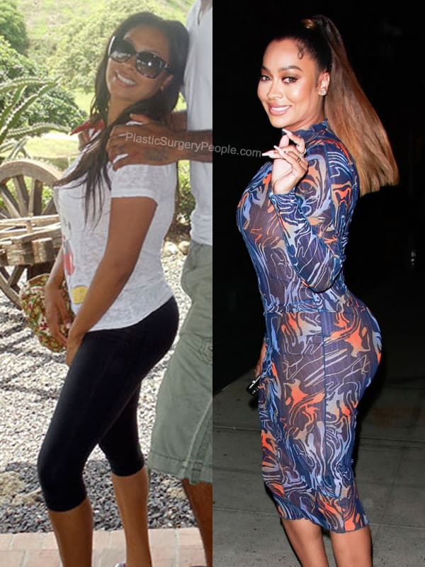 Lala Anthony butt lift before and after photo