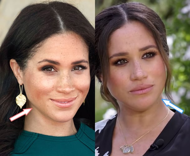 Has Meghan Markle Had Plastic Surgery? (Before & After 2022)