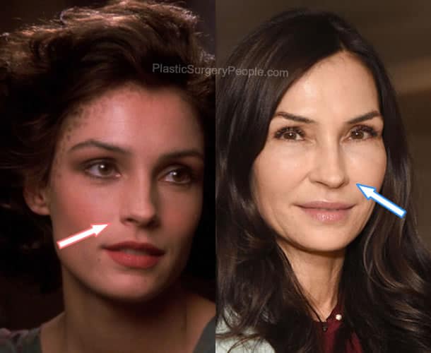 Famke Janssen nose job before and after photo comparison
