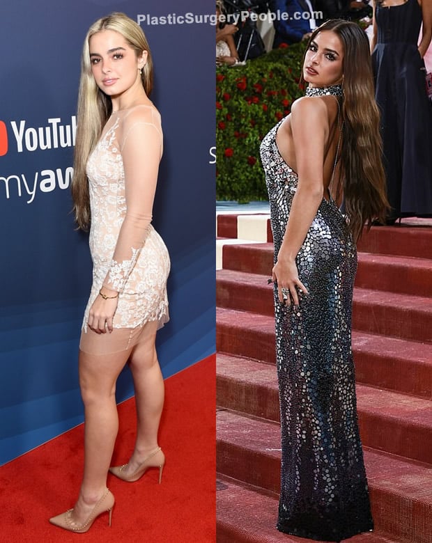Addison Rae butt lift before and after photo