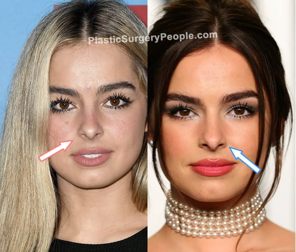Addison Rae nose job before and after photo
