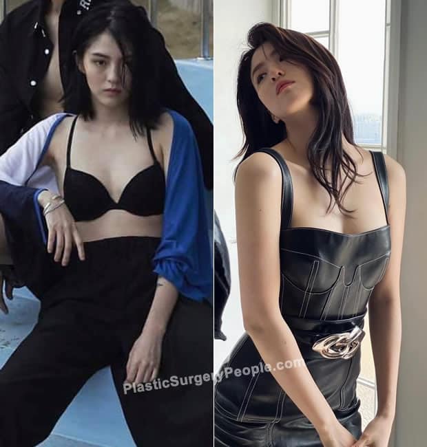Han So Hee boob job before and after photo