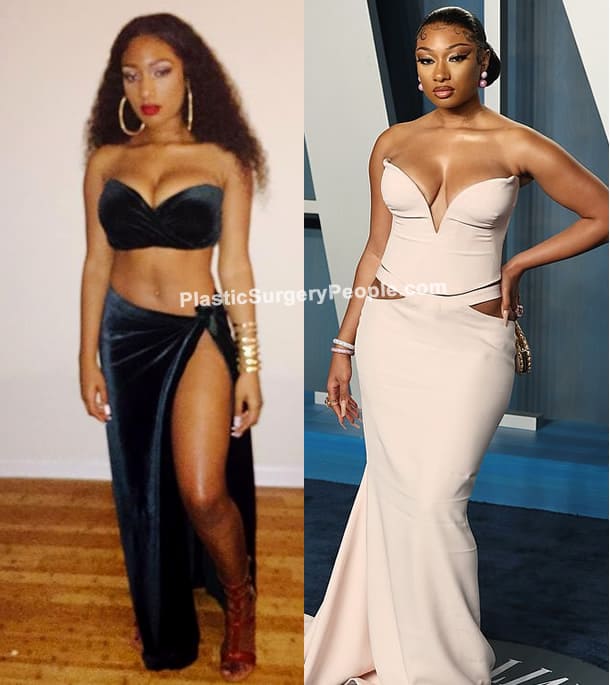 Megan Thee Stallion boob job before and after photo