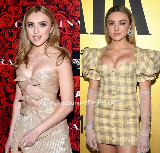 Peyton List boob job before and after photo