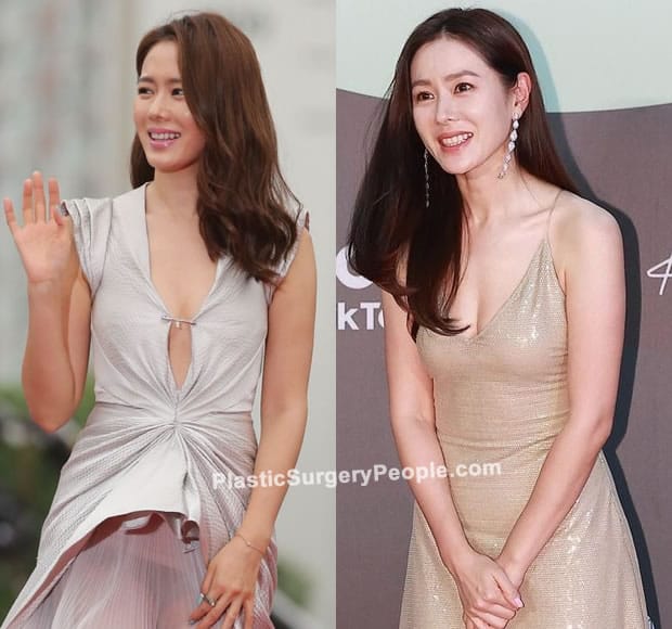 Son Ye Jin boob job before and after photo